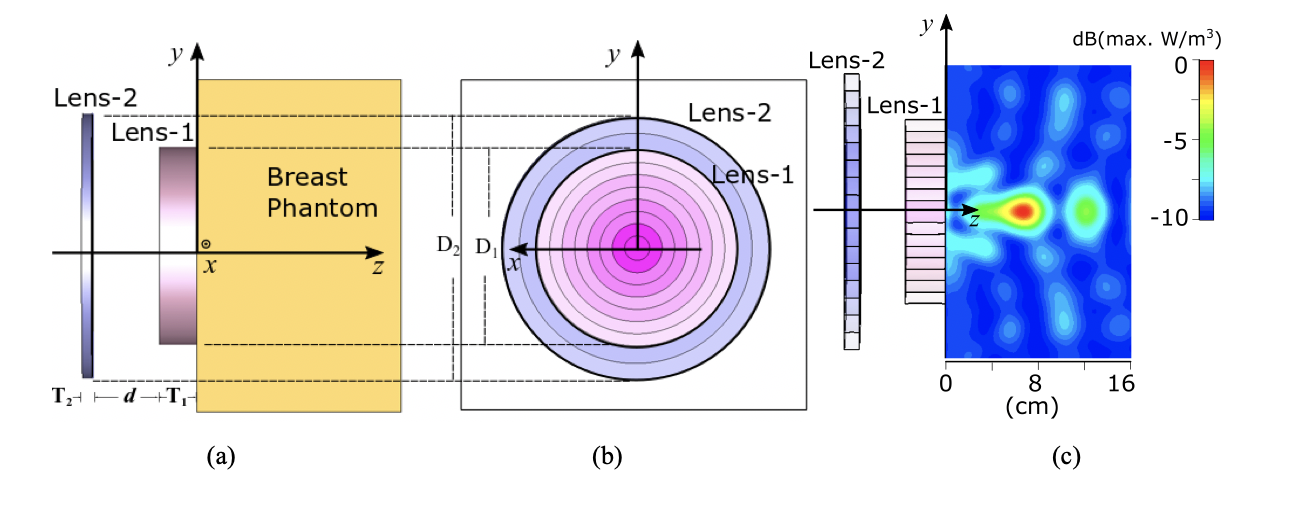 Dual Graded Index Dielectric Lens System for Hyperthermia